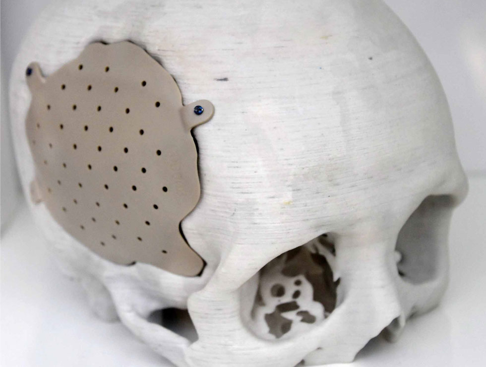 �@������ɫ�ĸ�ˎ��������Ŀ��������3D��ӡ���XĤ��